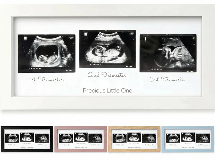 Newborn Sonogram Memory Picture Frame